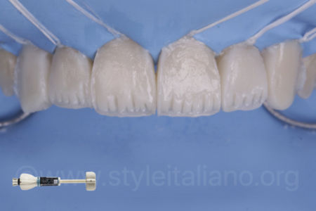 THE #WHITEOLOGY APPROACH_Osama Shalaan_StyleItaliano_ClinicalCase_02