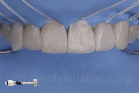 THE #WHITEOLOGY APPROACH_Osama Shalaan_StyleItaliano_ClinicalCase_03 THE #WHITEOLOGY APPROACH_Osama Shalaan_StyleItaliano_ClinicalCase_03