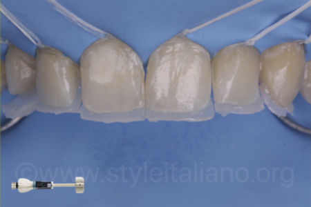 THE #WHITEOLOGY APPROACH_Osama Shalaan_StyleItaliano_ClinicalCase THE #WHITEOLOGY APPROACH_Osama Shalaan_StyleItaliano_ClinicalCase
