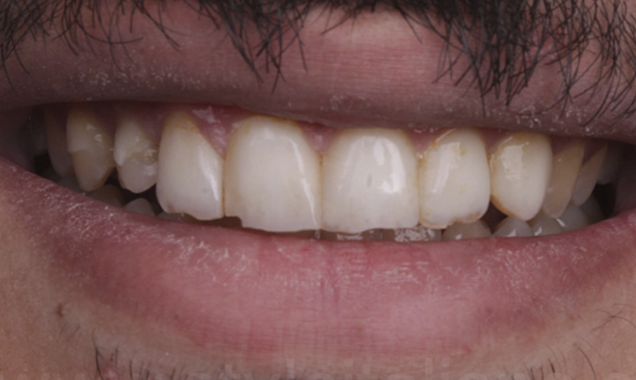 clinical-case-styleitaliano_osama1
