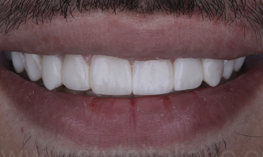 clinical-case-styleitaliano_osama_finalresult