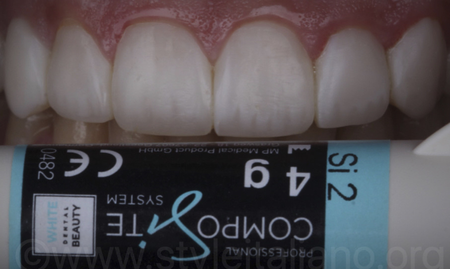 clinical-case-styleitaliano_osama_followup