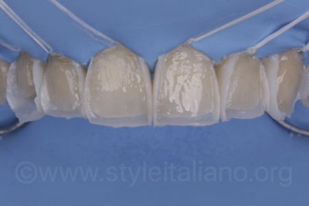 THE #WHITEOLOGY APPROACH_Osama Shalaan_StyleItaliano_ClinicalCase_02 THE #WHITEOLOGY APPROACH_Osama Shalaan_StyleItaliano_ClinicalCase_02