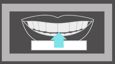 white dental beauty whitening strips step 2