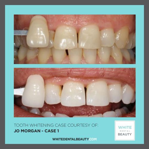 Jo-Morgan-case-12 Jo-Morgan-case-12